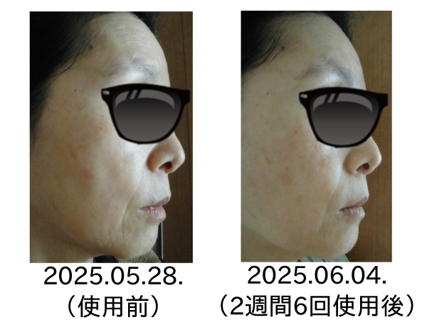 【体験レビュー】カレントボディLEDマスク2の効果は?シワ・たるみ悩みにおすすめできる理由